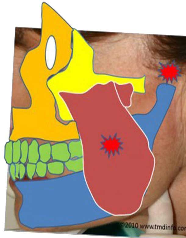 Dentista Broni, Oltrepo Pavese Pulizia Dentale, Impianti Dentali allineamento dentale ortodonzia invisibile