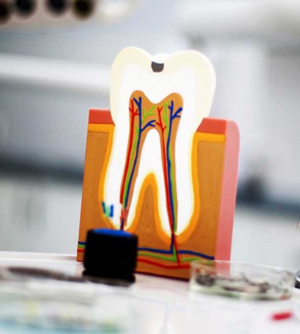 Dentista Broni, Oltrepo Pavese Pulizia Dentale, Impianti Dentali cura mal di dente