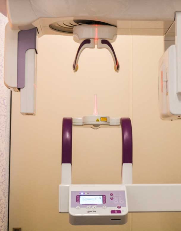 Dentista Broni, Oltrepo Pavese Pulizia Dentale, Impianti Dentali allineamento dentale ortodonzia invisibile